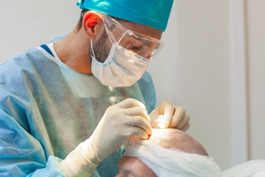 فحص الجراح أثناء زراعة الشعر